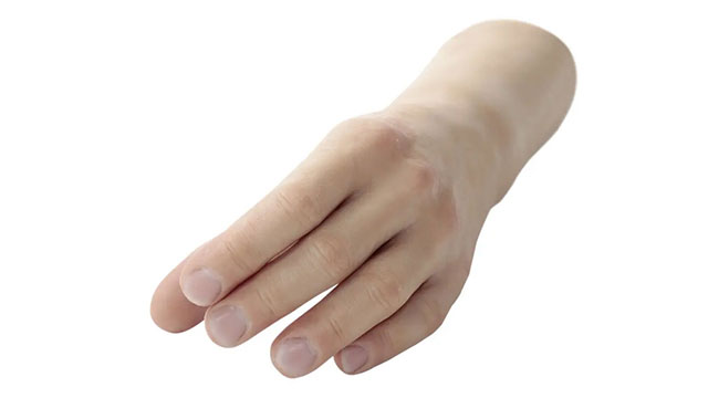 MyoSkin Natural