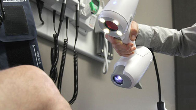 3D SCANNERS